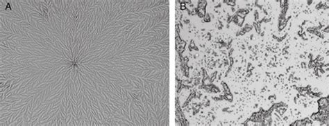 tear film ferning test|The tear ferning test: a simple clinical technique to evaluate .